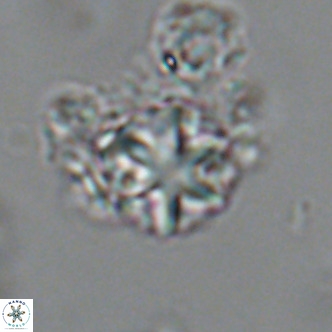 Olladiscoaster catinatus VR 18453