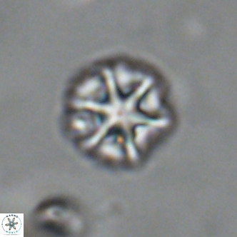 Olladiscoaster catinatus VR 18454