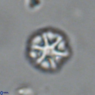 Olladiscoaster catinatus VR 18455