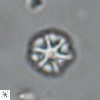 Olladiscoaster catinatus VR 18455