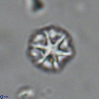 Olladiscoaster catinatus VR 18456
