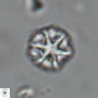 Olladiscoaster catinatus VR 18456