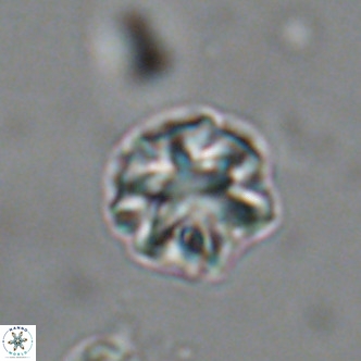 Olladiscoaster catinatus VR 18457