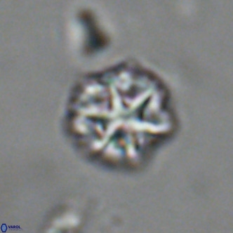 Olladiscoaster catinatus VR 18458