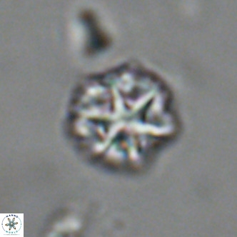 Olladiscoaster catinatus VR 18458