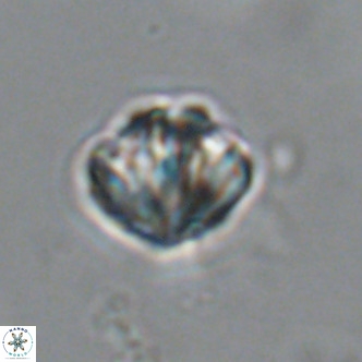 Olladiscoaster catinatus VR 18459