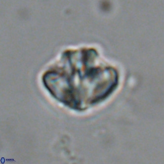Olladiscoaster catinatus VR 18460