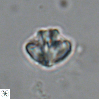 Olladiscoaster catinatus VR 18460
