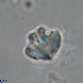 Olladiscoaster catinatus VR 18461