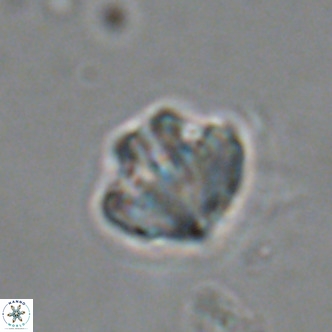 Olladiscoaster catinatus VR 18461