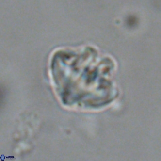 Olladiscoaster catinatus VR 18462