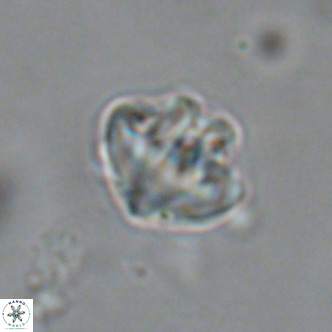 Olladiscoaster catinatus VR 18462