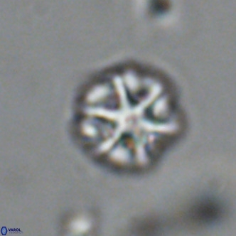 Olladiscoaster catinatus VR 18463