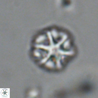 Olladiscoaster catinatus VR 18463
