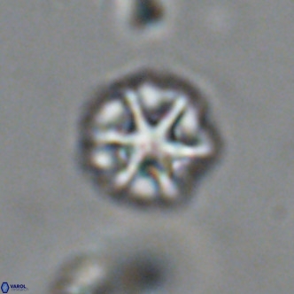 Olladiscoaster catinatus VR 18465