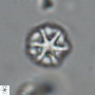 Olladiscoaster catinatus VR 18465