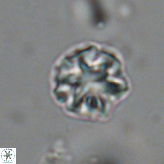 Olladiscoaster catinatus VR 18466