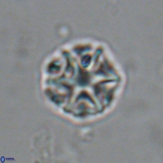 Olladiscoaster catinatus VR 18467