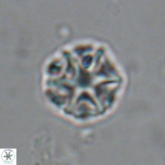 Olladiscoaster catinatus VR 18467