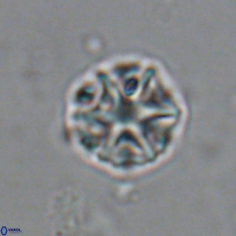Olladiscoaster catinatus VR 18468