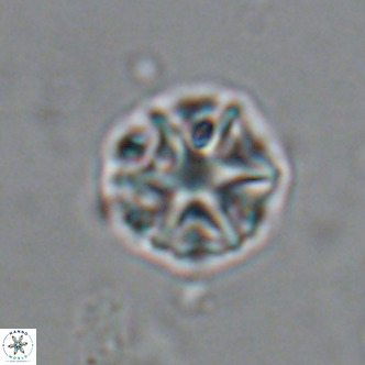 Olladiscoaster catinatus VR 18468