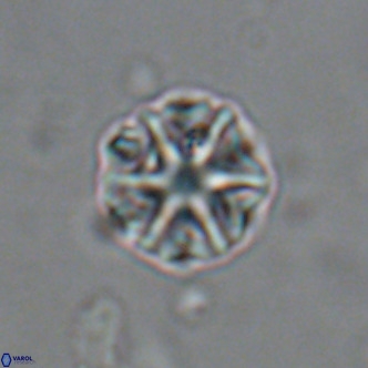 Olladiscoaster catinatus VR 18469