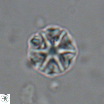 Olladiscoaster catinatus VR 18469