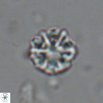 Olladiscoaster catinatus VR 18470
