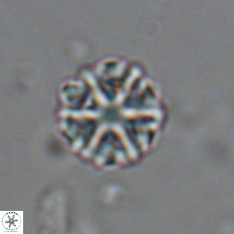 Olladiscoaster catinatus VR 18471