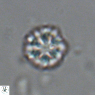 Olladiscoaster catinatus VR 18472