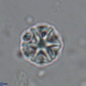 Olladiscoaster catinatus VR 18473