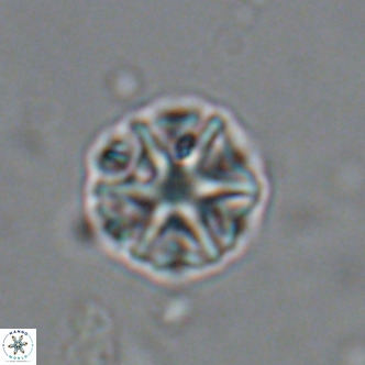 Olladiscoaster catinatus VR 18473