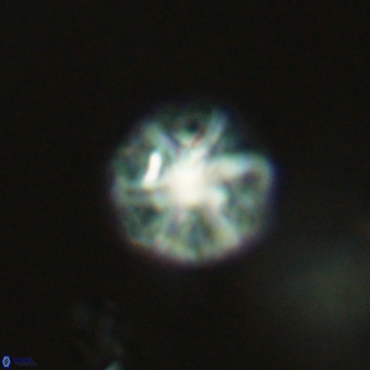 Olladiscoaster catinatus VR 18475