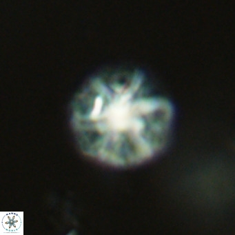 Olladiscoaster catinatus VR 18475