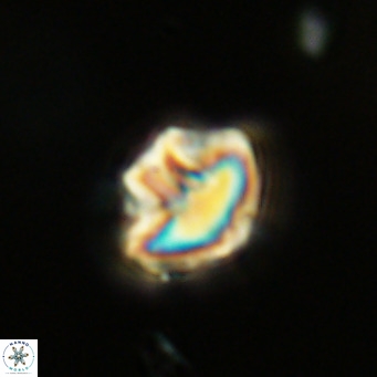Olladiscoaster catinatus VR 18476