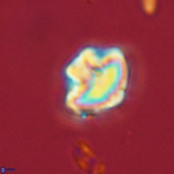 Olladiscoaster catinatus VR 18477