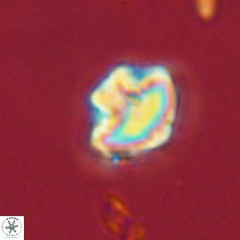 Olladiscoaster catinatus VR 18477