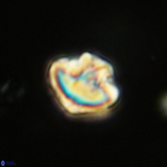 Olladiscoaster catinatus VR 18479