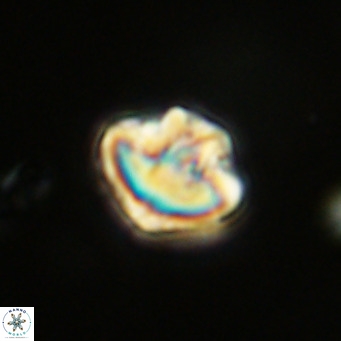 Olladiscoaster catinatus VR 18479