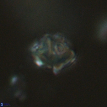 Olladiscoaster catinatus VR 18481
