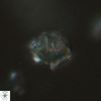 Olladiscoaster catinatus VR 18481