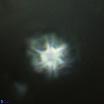 Olladiscoaster catinatus VR 18483