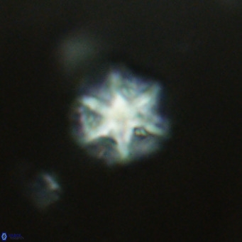 Olladiscoaster catinatus VR 18484