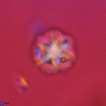 Olladiscoaster catinatus VR 18485