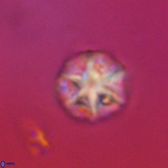 Olladiscoaster catinatus VR 18486
