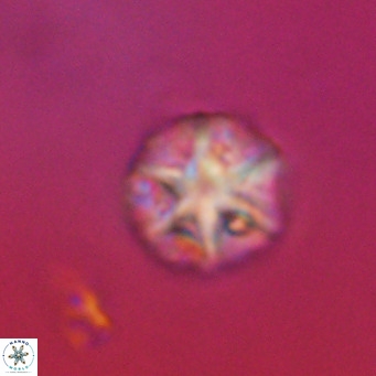 Olladiscoaster catinatus VR 18486