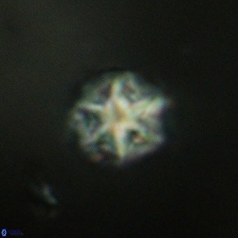 Olladiscoaster catinatus VR 18487