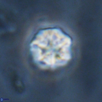 Olladiscoaster catinatus VR 18488