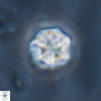 Olladiscoaster catinatus VR 18488