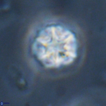 Olladiscoaster catinatus VR 18489